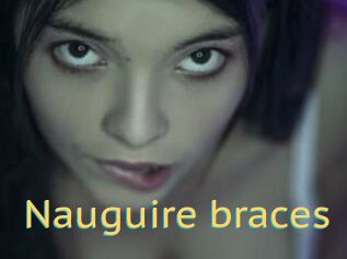 Nauguire_braces